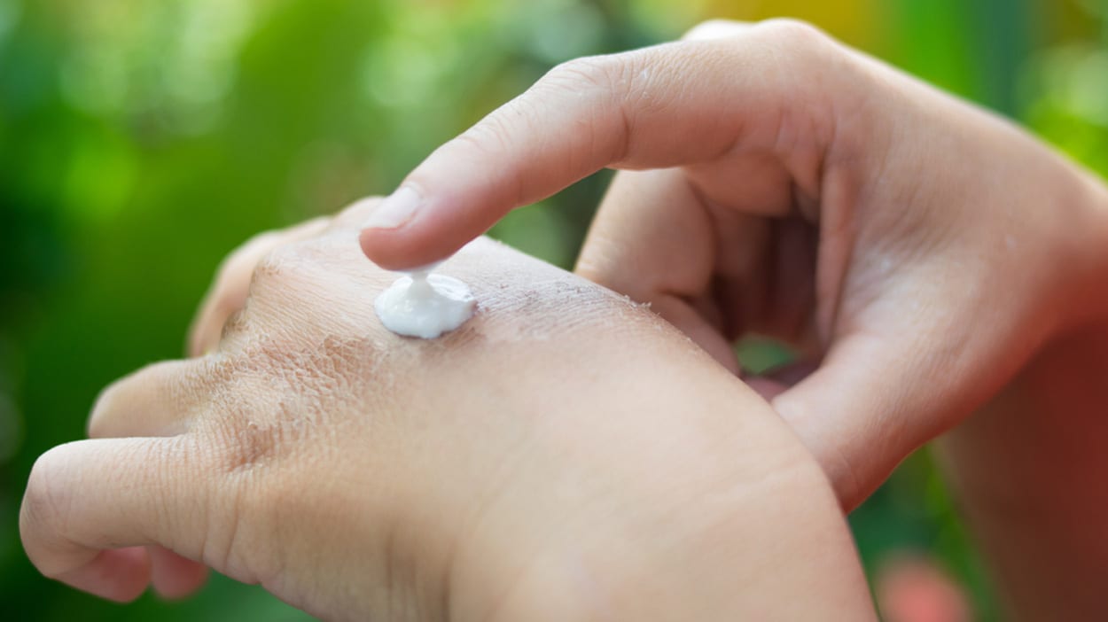 Can I expose my scar to the sun? ALHYDRAN