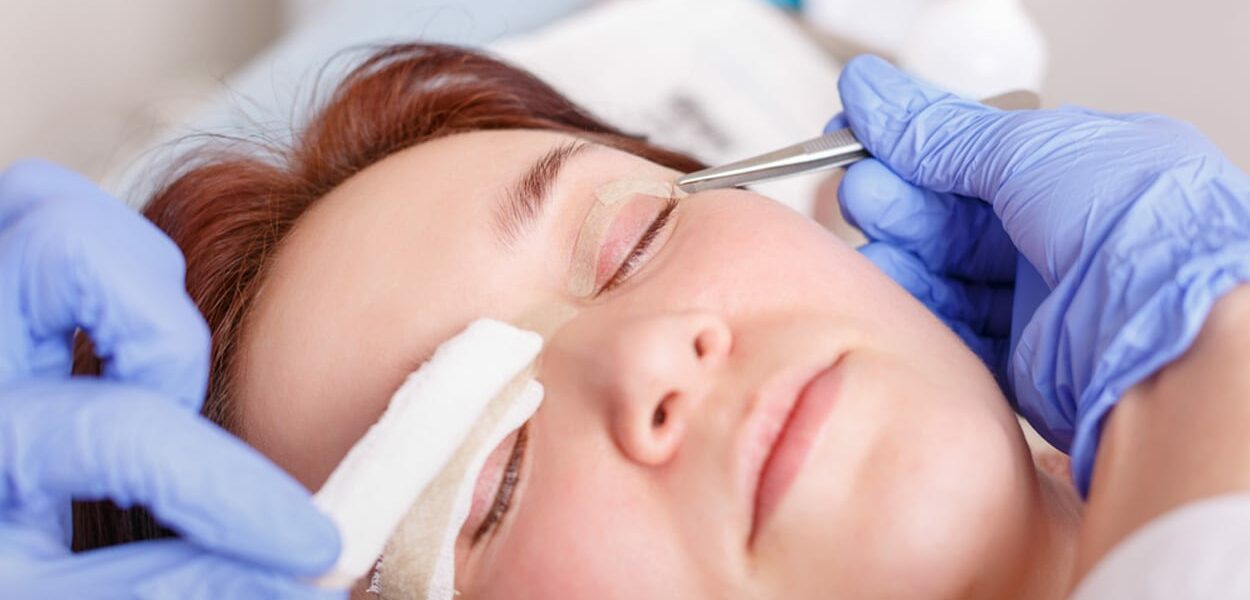 Scar cream can be used after eyelid surgery