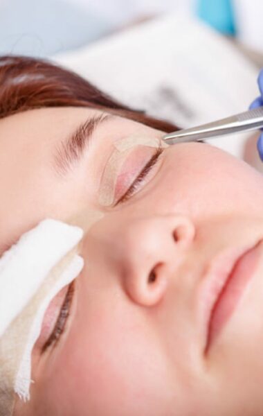 Scar cream can be used after eyelid surgery