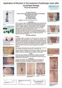 ALHYDRAN clinical study - Application of Alhydran in the treatment of pathologic scars after cryoshape therapy
