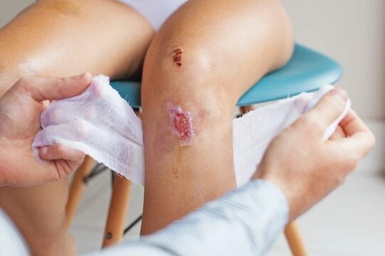 ALHYDRAN wound treatment