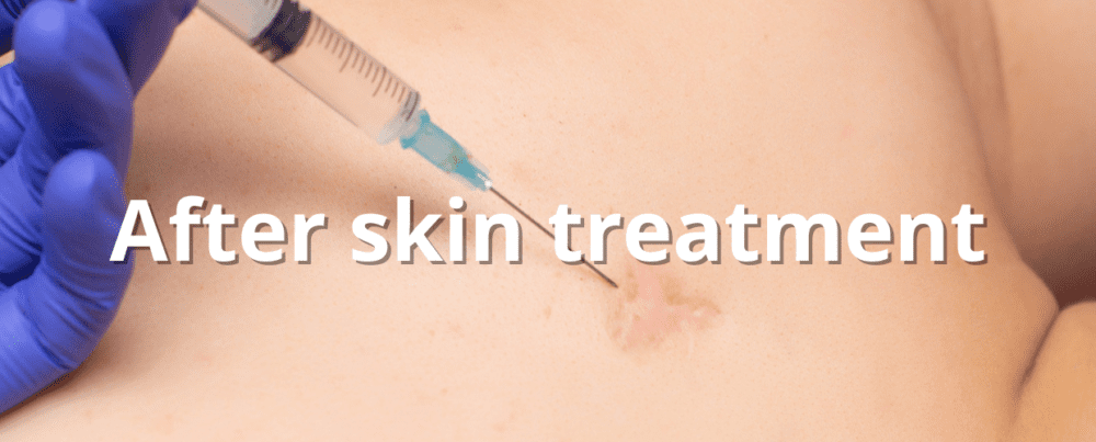 skin treatment