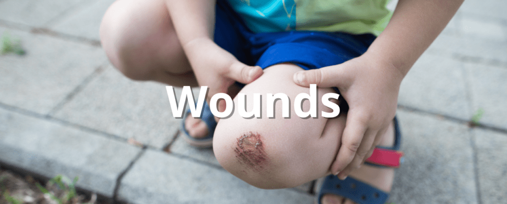 wounds